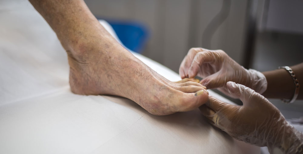 examining seniors foot